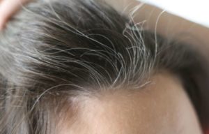 How to get rid of white hair