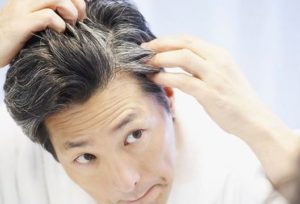 Premature graying hair or premature gray hair causes treatment