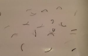 two-hairs-one-follicle