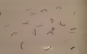 One growing multiple follicle from hairs Multiple Hairs