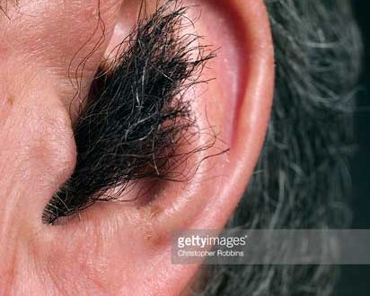 Permanent Hair Removal At Home Natural Permanent Hair Removal At Home Natural
