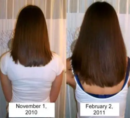 Before and after pictures monistat for hair growth