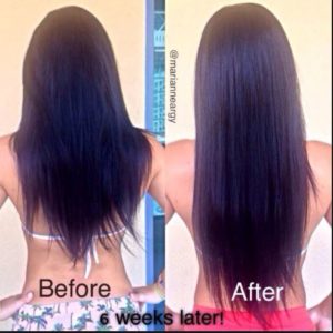 Folic acid before and after photos hair growth