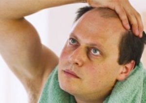 Hair loss can cause hair to start receding in men