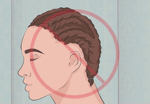 Excessive styling can also lead to front hairline hair loss