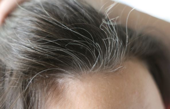 How to get rid of white hair
