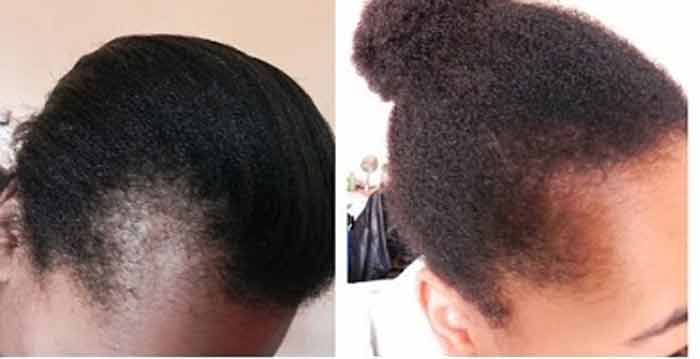 argan before and after edges