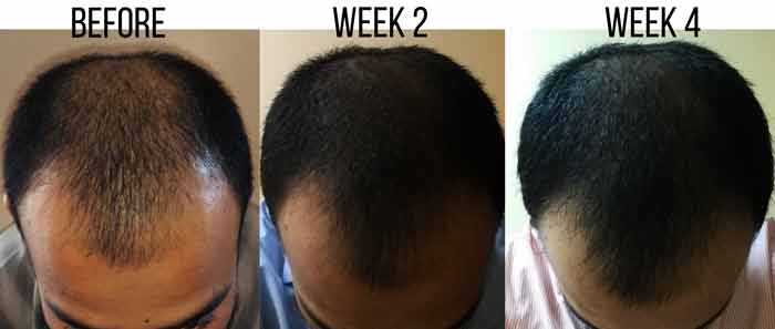 Morrocan Organic Argan oil before and after-Men