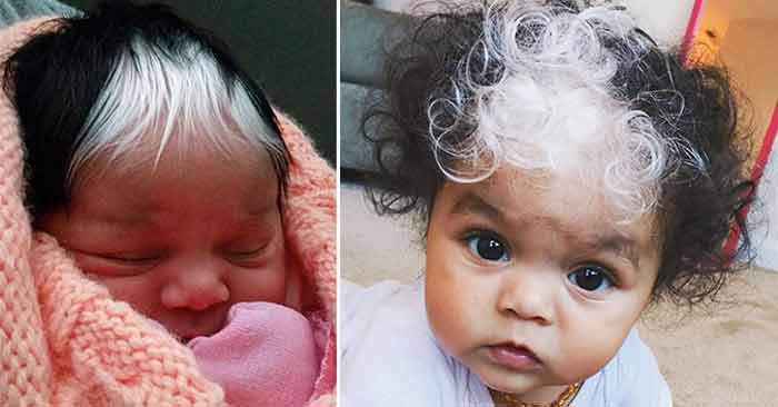 MilliAnna-born with white-patch of hair