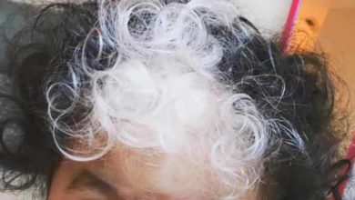 Photo of Baby Born with White Hair-Causes & Treatment