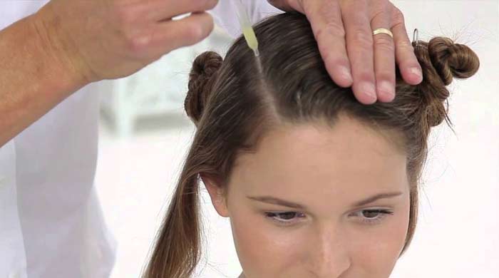nioxin scalp treatment therapy and recovery